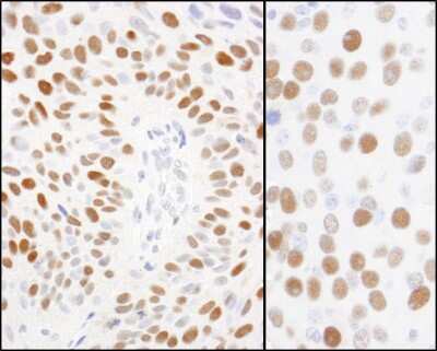 Immunohistochemistry-Paraffin: MCM2 [p Ser108] Antibody [NB100-639]